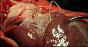 Heartworm in the heart